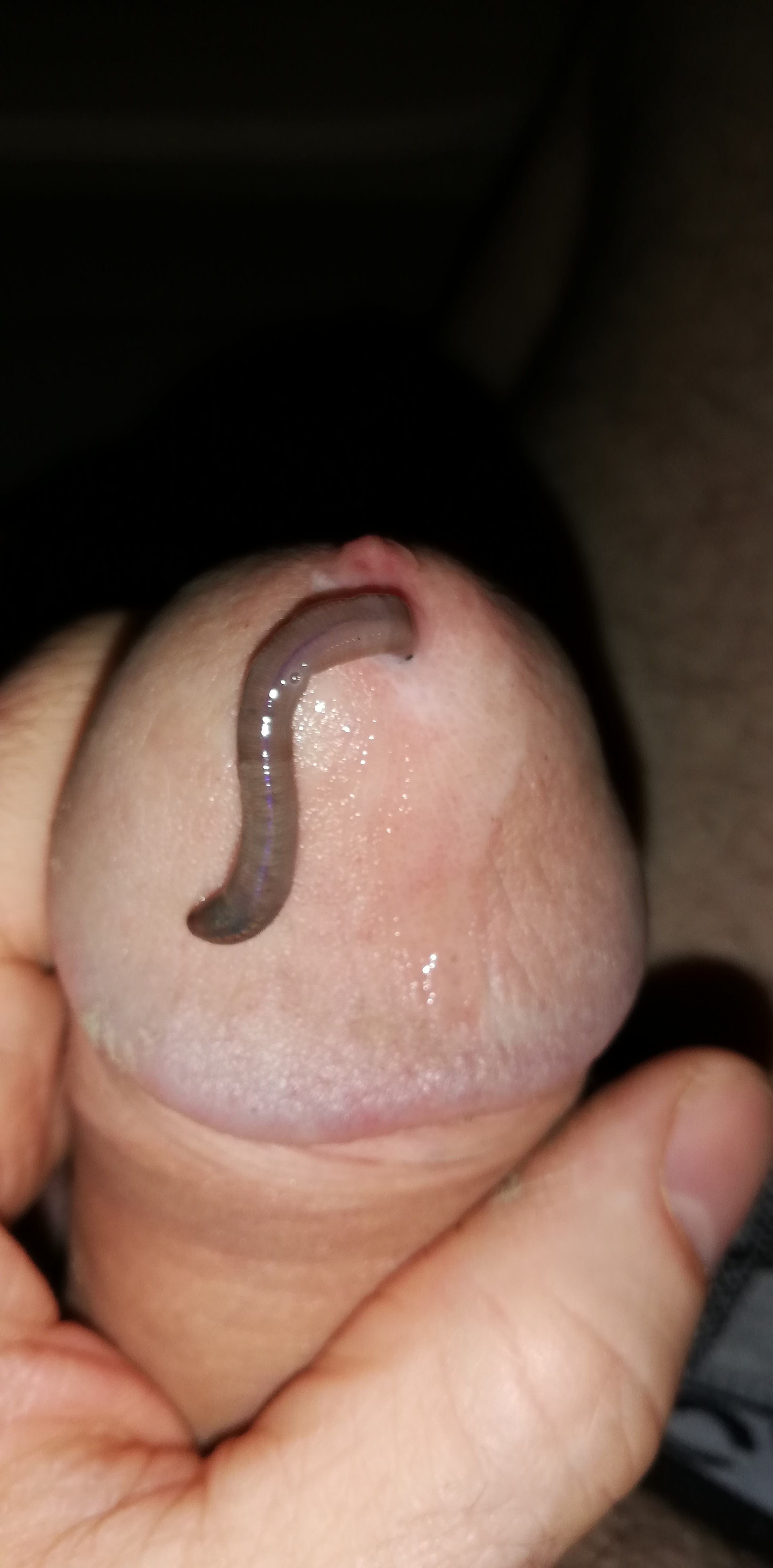 Game with worm — 9